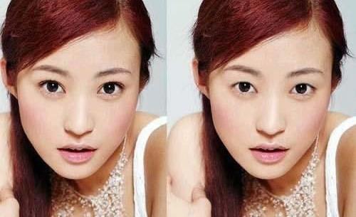 雙眼皮手術留疤了要怎么辦