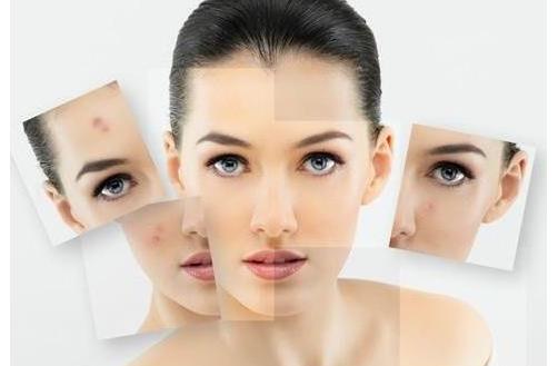 哪種手段治療痘坑更有效呢?