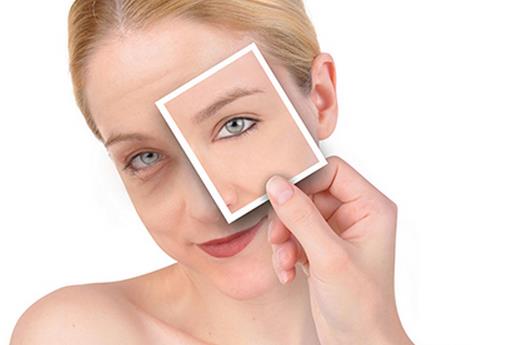 如何去除腫眼泡及后遺癥