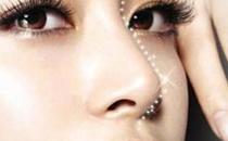 鼻部整形失敗表現及鼻部整形修復