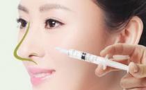 注射隆鼻具體有什么優勢