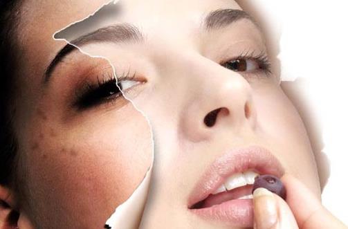 天然無刺激的祛痘小妙招 幫你趕跑痘痘