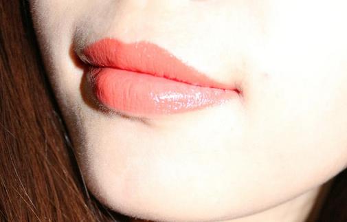 口角裂整形前的準備與術(shù)后護理