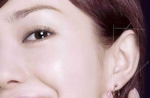 耳部整形手術注意事項