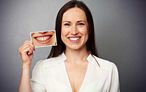 美白牙齒有妙招!