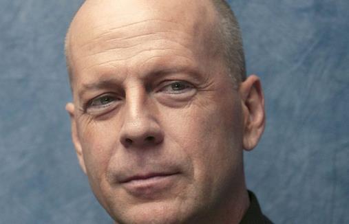 禿頭男是怎樣煉成的?