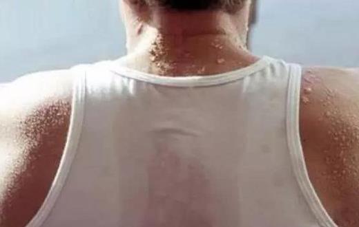 常出汗是病?老人出汗異常的癥狀