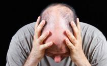 6招簡單防男性脫發