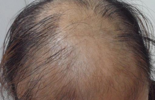 男性養(yǎng)生必知:男人性衰老7大跡象