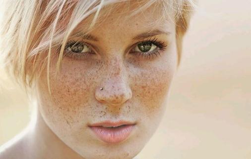 雀斑和吃鹽有關系？雀斑會遺傳嗎？