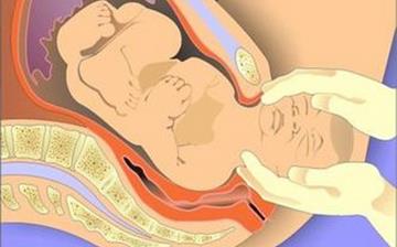 【難產】孕婦難產是什么癥狀_難產注意什么_難產為什么要剖腹產 【難產】孕婦難產是什么癥狀_難產注意什么_難產為什么要剖腹產