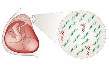 【遺傳病】遺傳病有哪些_家族遺傳病都有哪些_遺傳病的特點(diǎn) 【遺傳病】遺傳病有哪些_家族遺傳病都有哪些_遺傳病的特點(diǎn)