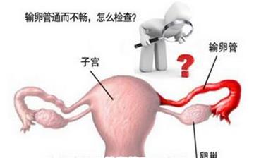 【輸卵管堵塞】輸卵管堵塞的癥狀_輸軟管堵塞檢查項目有哪些_輸軟管不通怎么治療 【輸卵管堵塞】輸卵管堵塞的癥狀_輸軟管堵塞檢查項目有哪些_輸軟管不通怎么治療