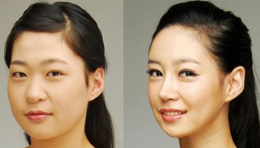 咬肌瘦臉針有什么危害?