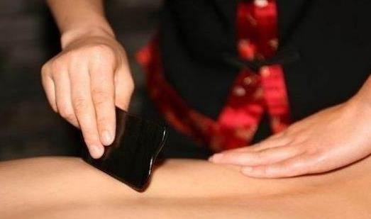 刮痧可以減肥嗎?需注意什么?