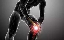 引起關節炎的原因有哪些？