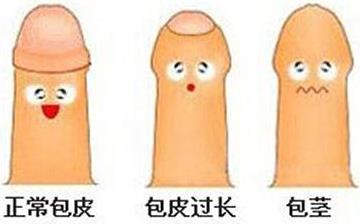 【包皮包莖】包皮包莖有哪些癥狀_包皮包莖如何治療_包皮包莖的原因