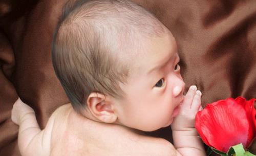 新生兒黃疸的預(yù)防護理