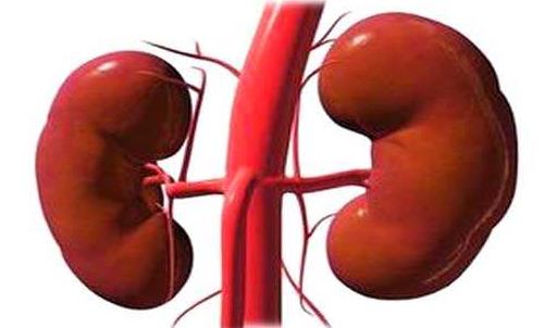 腎結石會帶來什么危害