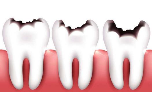 牙齒衰老的癥狀你知道么？