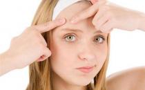 長痘痘的原因都有哪些