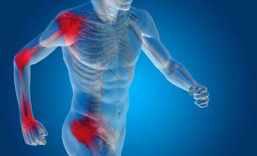 是什么動作傷害了你的關節