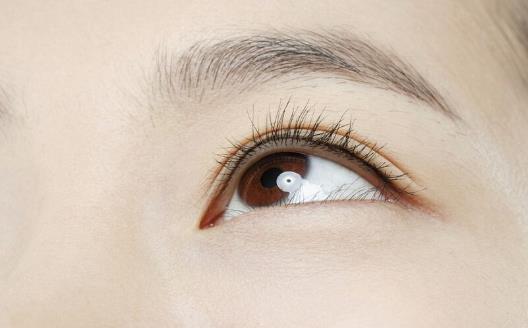 哪些原因會誘發青光眼