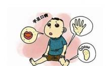 什么是手足口病？手足口病怎么治療