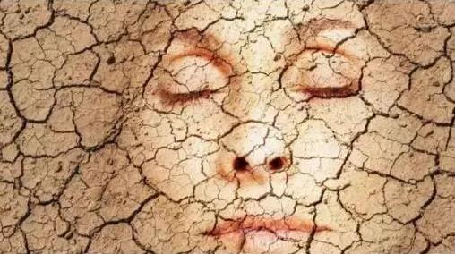 改善面部皮膚太粗糙方法 冬季皮膚干燥起皮原因