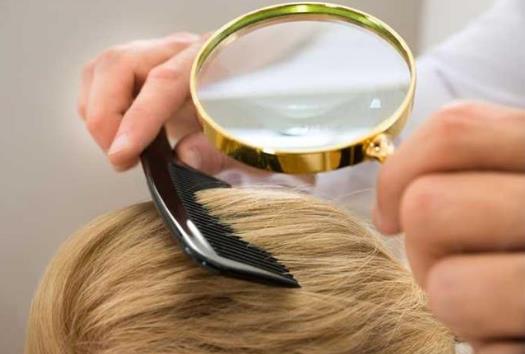引起脫發的原因 學會這些方法遠離掉頭發