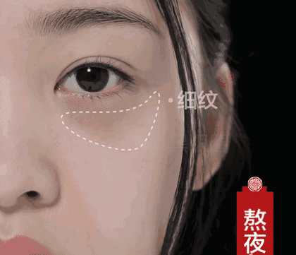 黑眼圈形成原因 4種營養9大飲食攆走女人“熊貓眼”