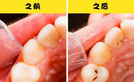 女性在分娩之后會(huì)經(jīng)歷7個(gè)不常見(jiàn)的身體變化