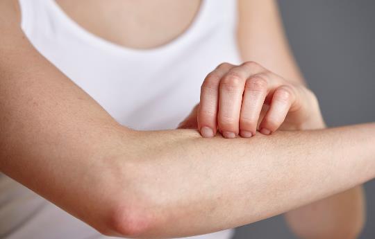 春季易引發(fā)的皮膚病 幾種方法助你輕松應(yīng)對