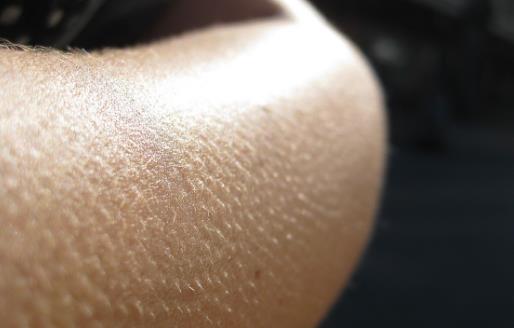 起雞皮疙瘩的反應 雞皮膚與雞皮疙瘩的差異