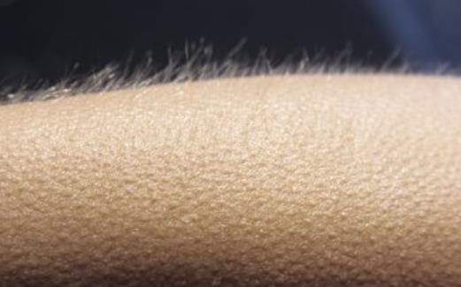 起雞皮疙瘩的反應 雞皮膚與雞皮疙瘩的差異