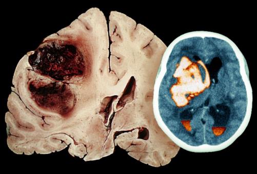 知道牙齒黃黃的原因嗎?真相原來是這樣