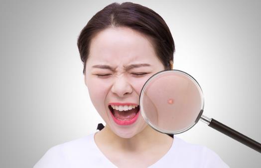 痘痘怎么消除，及時護理是必要的，如果臉上出現(xiàn)痘痘不要