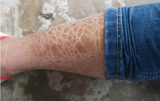 正確護(hù)理自己身體 要滋潤(rùn)這5處不要旱災(zāi)