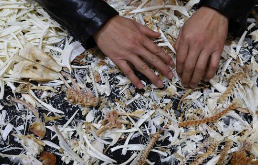 20個生活中的急救常識日常生活中，意外傷害很難避免，有時