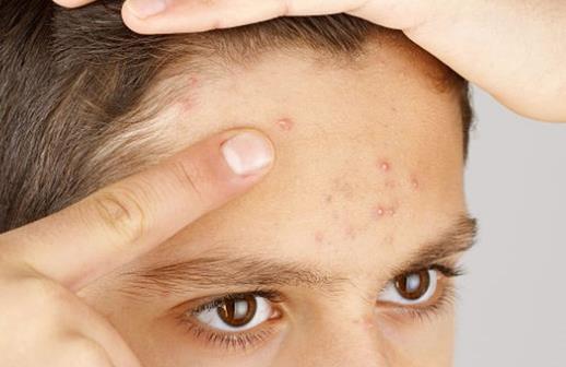 哪些癥狀需要排毒？怎么排解體內毒素