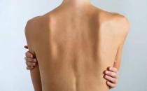 后背發涼是心理還是身體原因 后背發涼的調理方法