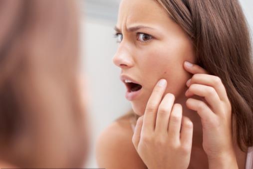 臉長痘痘遲遲不消 小心粉瘤來襲