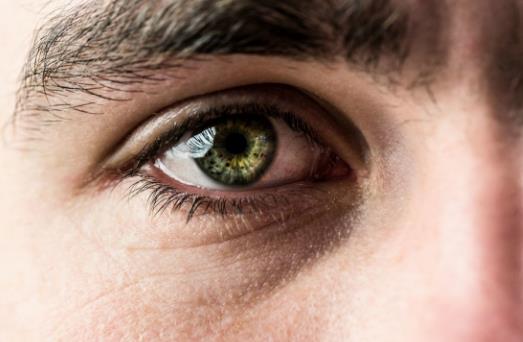 眼屎多居然暗示著這幾大疾病