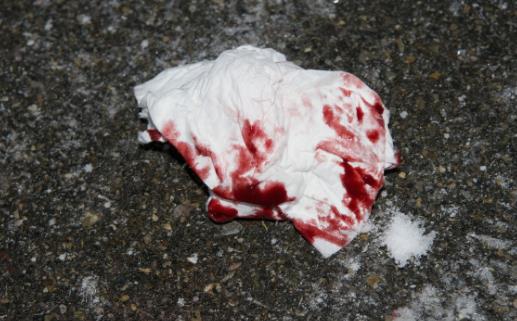 女性衰老的元兇揭秘 延緩衰老的方法推薦