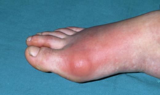 女性衰老的元兇揭秘 延緩衰老的方法推薦