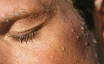 一覺醒來身上都是汗 調節環境溫度與濕度緩解夜汗