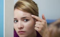 不同部位長(zhǎng)痘原因不同 視而不見會(huì)加重你的問題