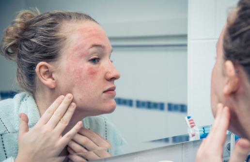 皮膚高度過敏選擇微酸性潔面 皮膚高度過敏注意事項