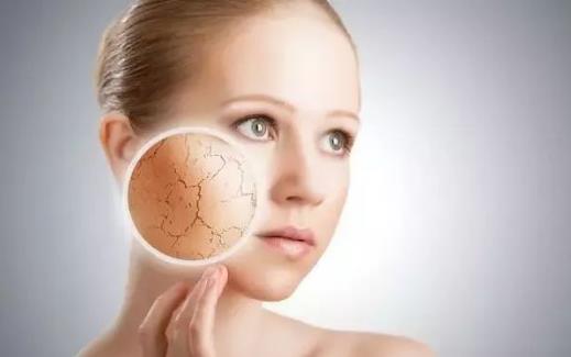 干性皮膚正確使用保濕面膜 干性皮膚日常注意事項