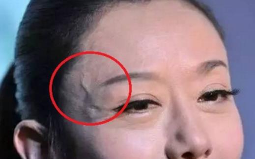 身上青筋凸起預示疾病風險 青筋暗示心血管疾病前兆